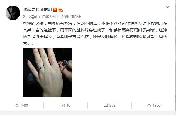 邹市明回应妻子手指被戒指卡住网友：戒指买小了